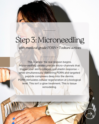 Microneedling with PDRN peptide infusion collagen induction therapy
